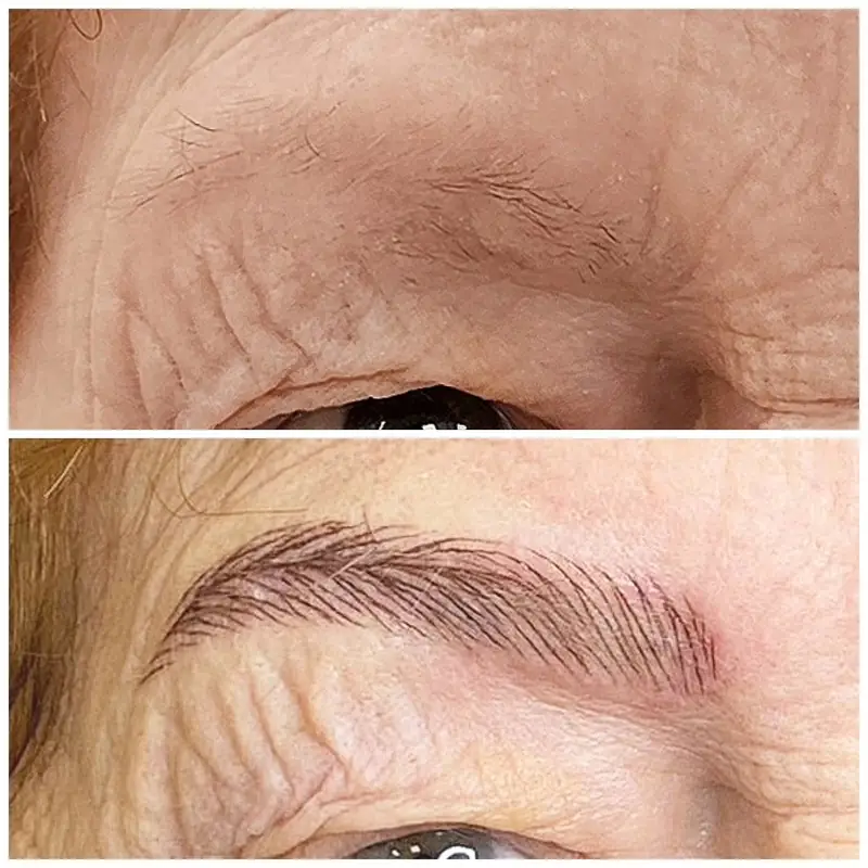 Antes y después, Monika Klara Nagy
