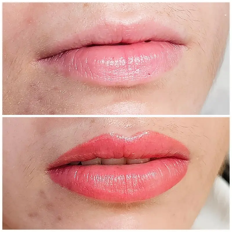 Labios, Monika Klara Nagy