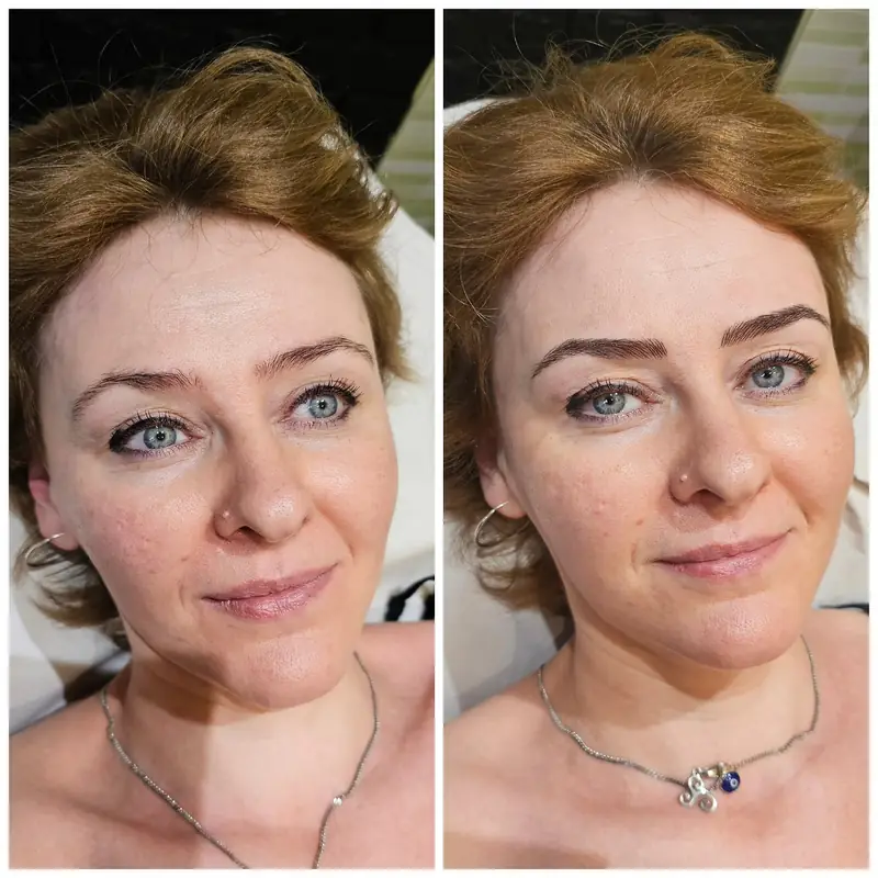 Antes y después, Monika Klara Nagy