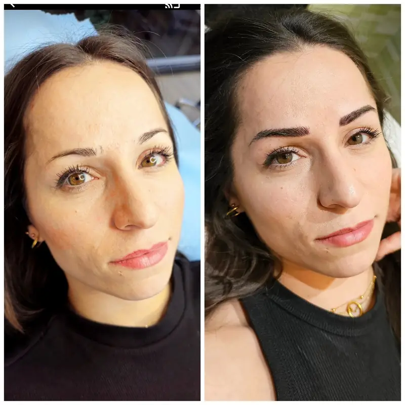 Antes y después, Monika Klara Nagy