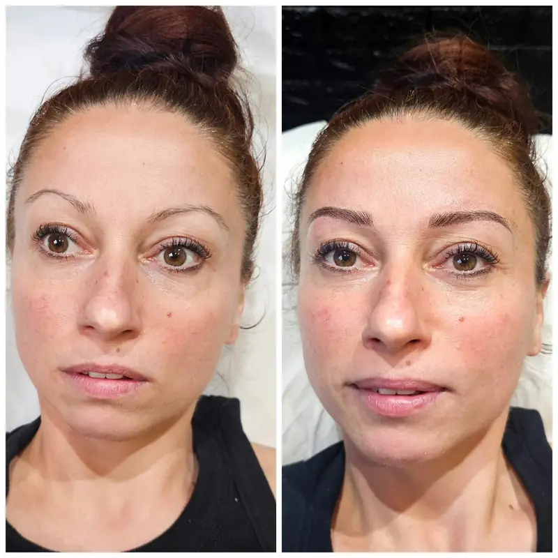 Antes y después, Monika Klara Nagy